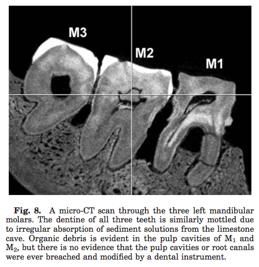 LB1 Homo floresiensis molars
